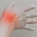 Причина за подагра при мъжете