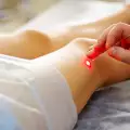 Защо се появяват разширени вени и можем ли да се предпазим?