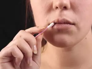 Бързи решения на проблеми с външния вид