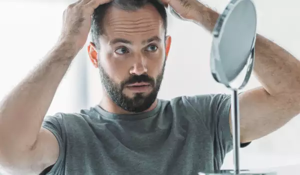 Причини за ранно побеляване на косата при мъжете